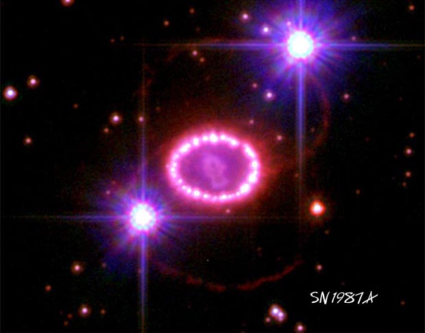 SN1987A